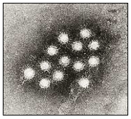 Mikrograf Elektron Transmisi Virus Hepatitis A