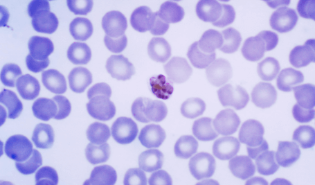 plasmodium malariae