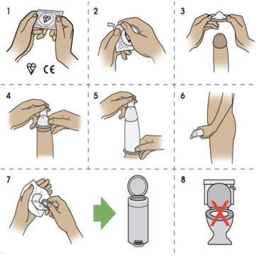 Gambar Langkah-Langkah Penggunaan Kondom