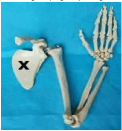 Contoh tulang lain yang serupa dengan bentuk tulang X